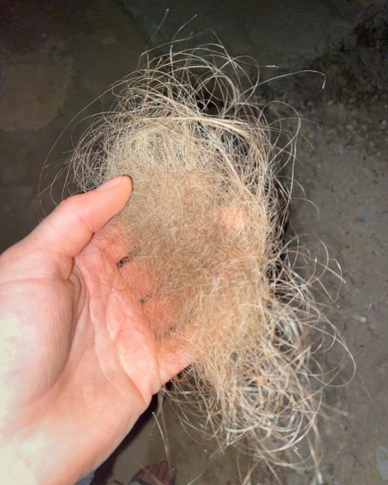 The American activist said Israeli settlers dragged her from her hair violently during the attack on Khirbet Humsa, ripping off a large chunk of it. She told CNN she thought she was going to die.