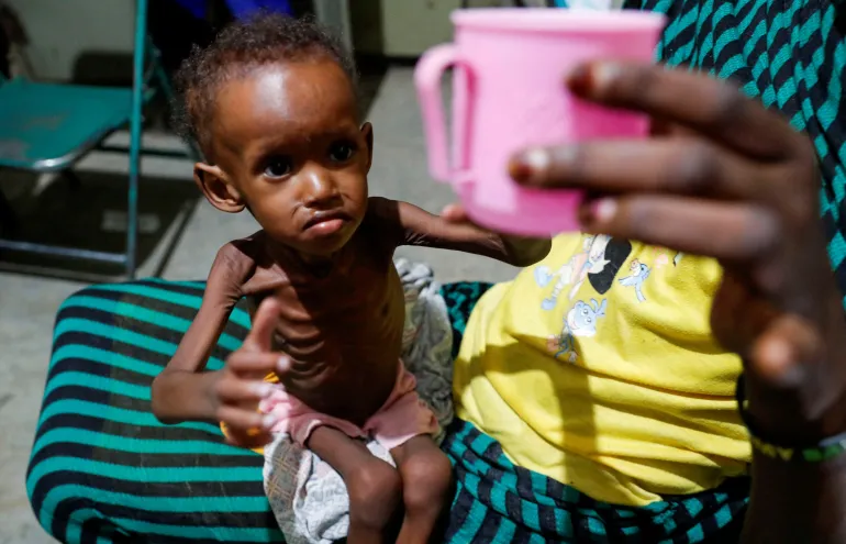 A malnourished 17-month-old internally displaced child reaches for water at a pediatric ward amid Sudan's humanitarian crisis.